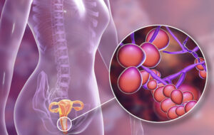 Read more about the article Infection