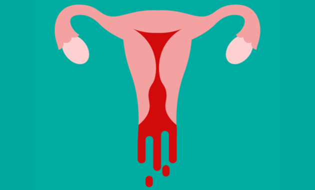 Read more about the article Bleeding