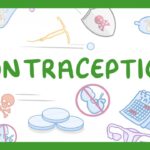 Contraception. 