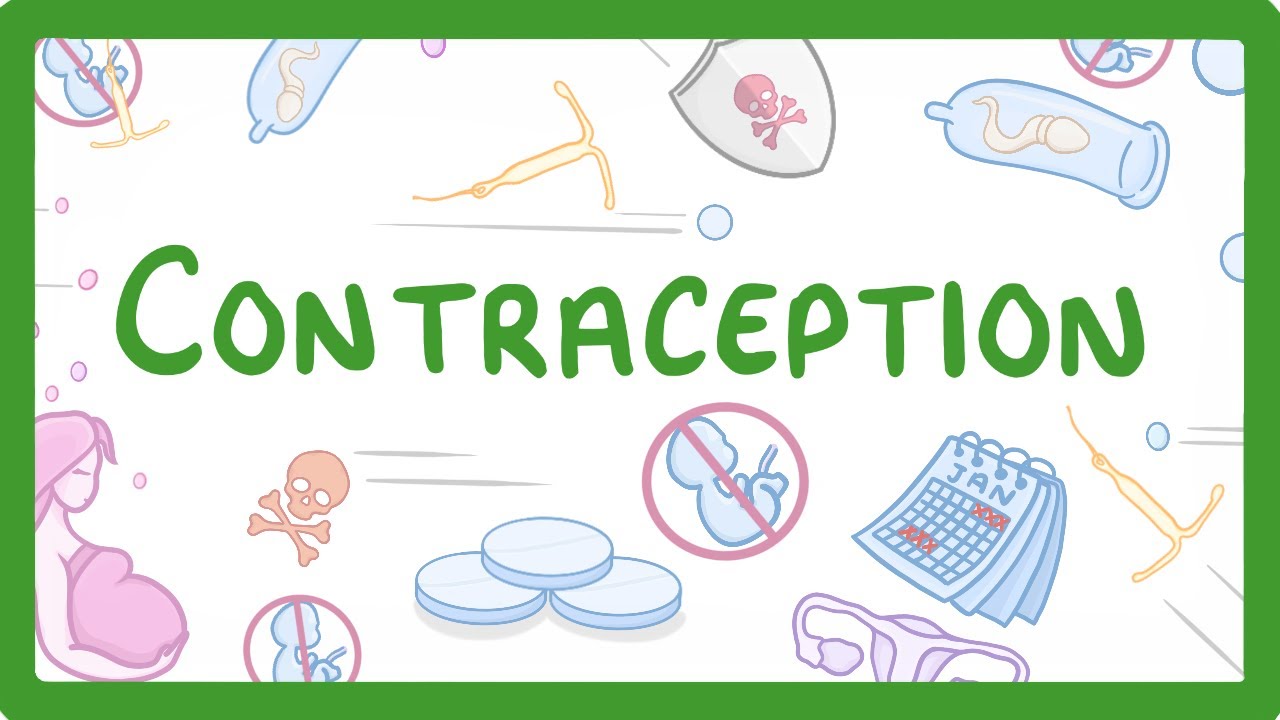 Read more about the article Contraception. 