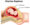 Abortions and Uterine Rupture. 