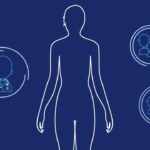 Safe Abortion Methods for a 5-Week Pregnancy 