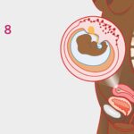 Safe Abortion Methods for a 8-Week Pregnancy 