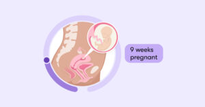 Read more about the article Terminating a 9-Week Pregnancy in Kenya  