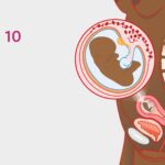 Termination of a 10-Week Pregnancy: Medical and Surgical Options