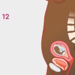Termination of a 12-Week Pregnancy: Medical and Surgical Options 