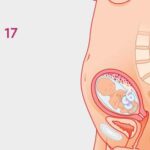 Understanding 17-Week Pregnancy Termination: What You Need to Know