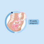  How to Terminate an 18-Week Pregnancy Safely