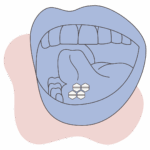 How to Use Misoprostol Safely: Sublingual vs Vaginal Administration