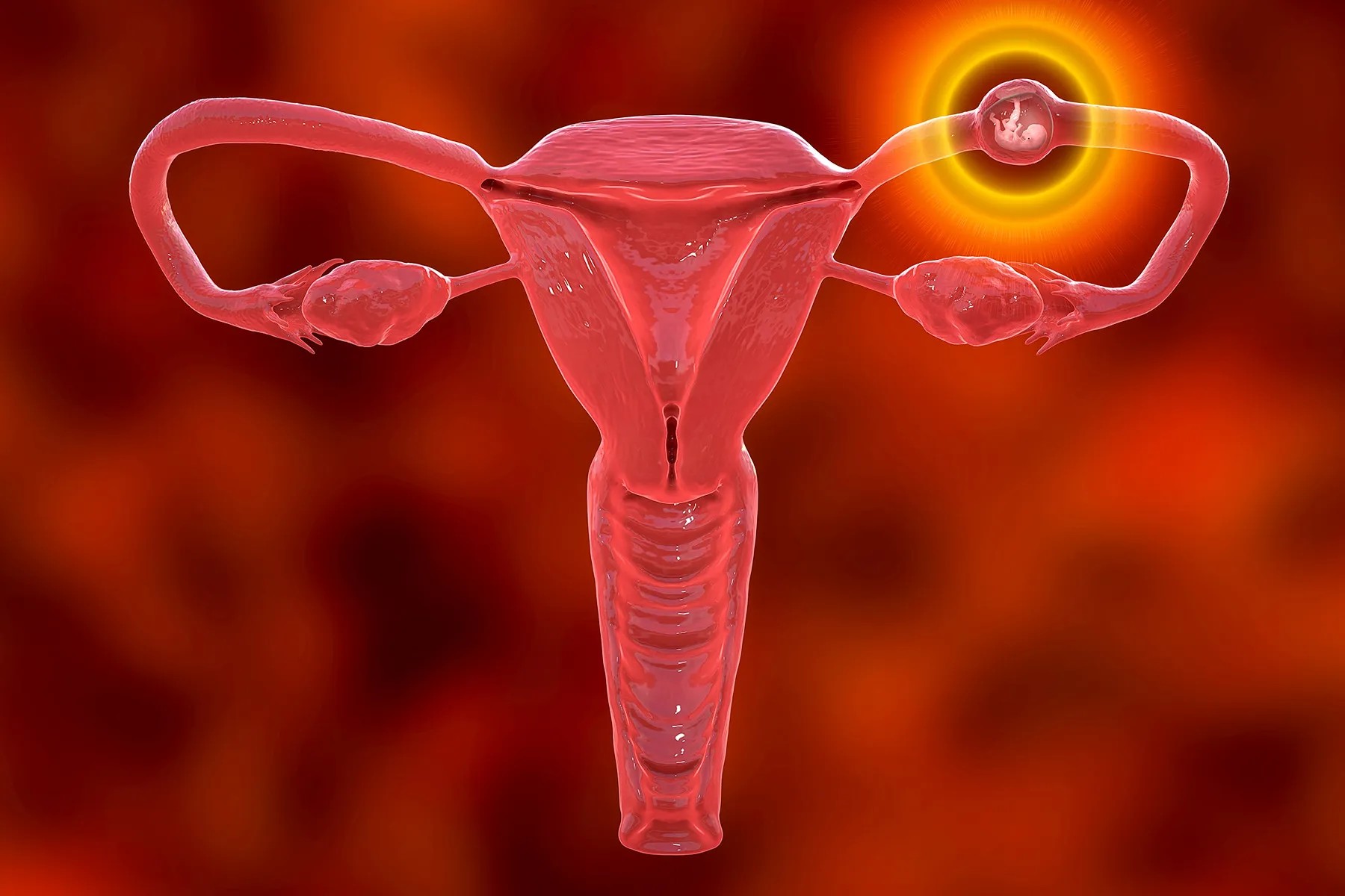 Read more about the article Ectopic Pregnancy: Signs, Symptoms, Types, and Management